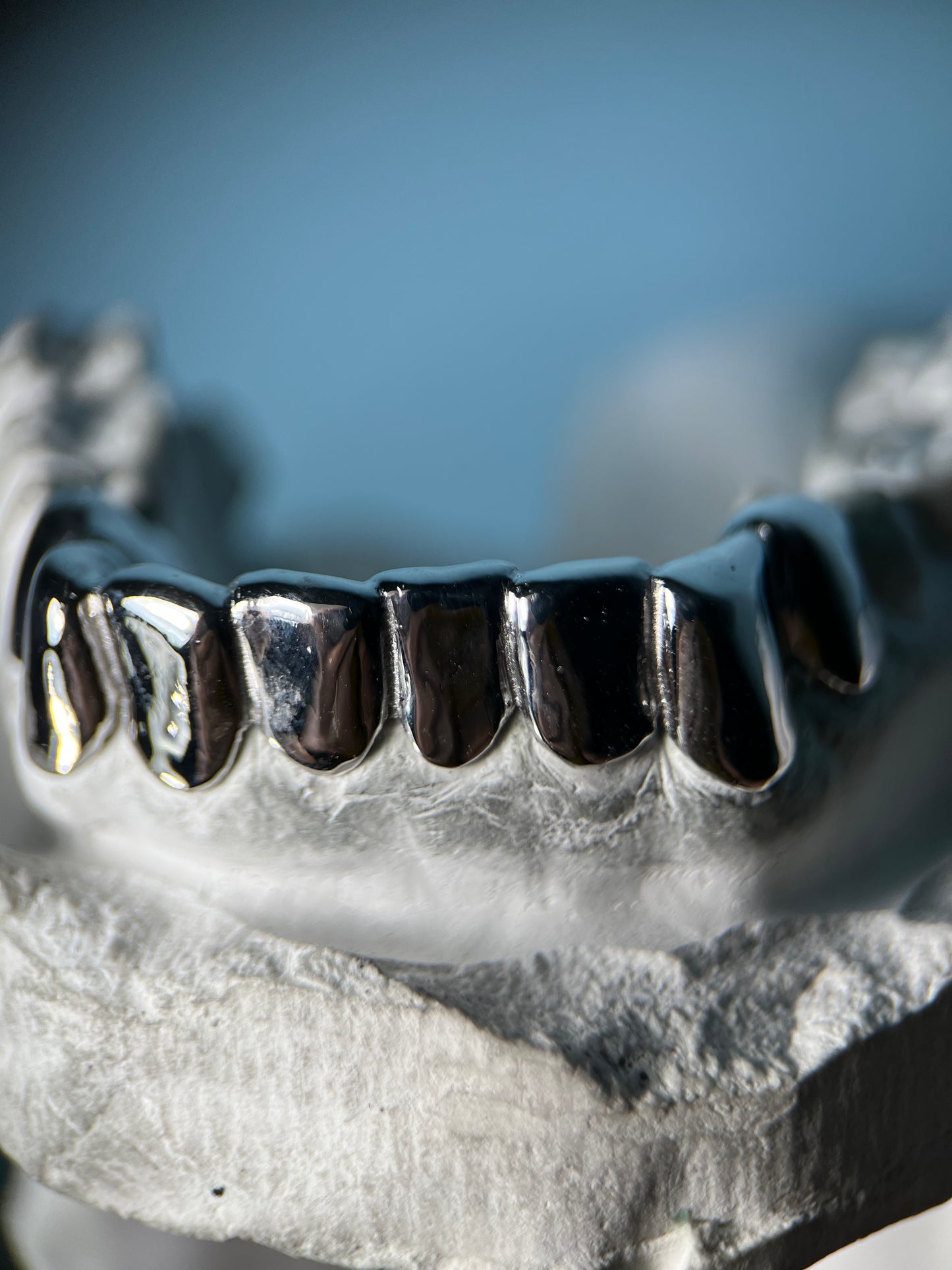 Custom Grillz By Maxwell The Jeweler