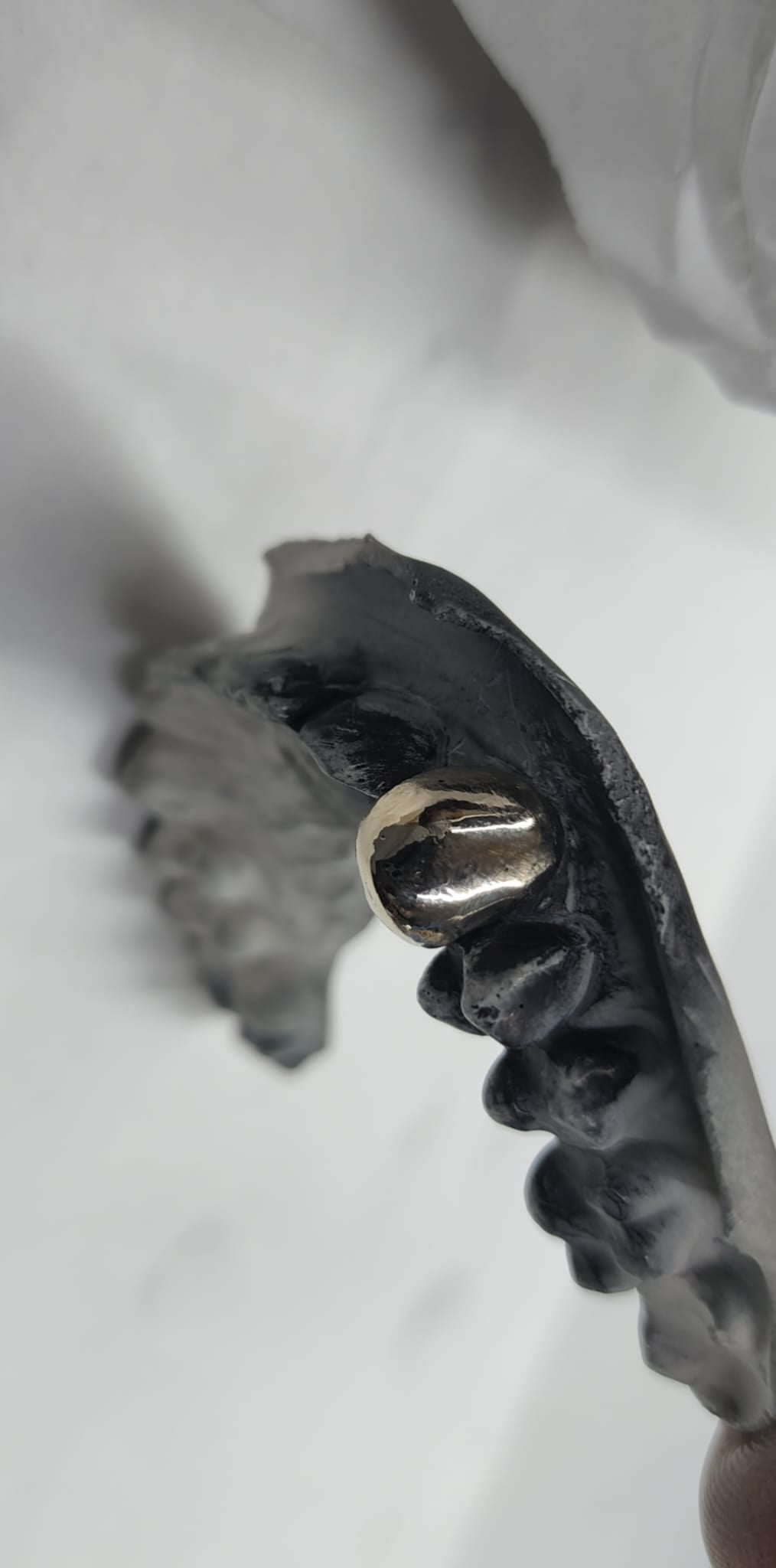 Custom Grillz By Maxwell The Jeweler