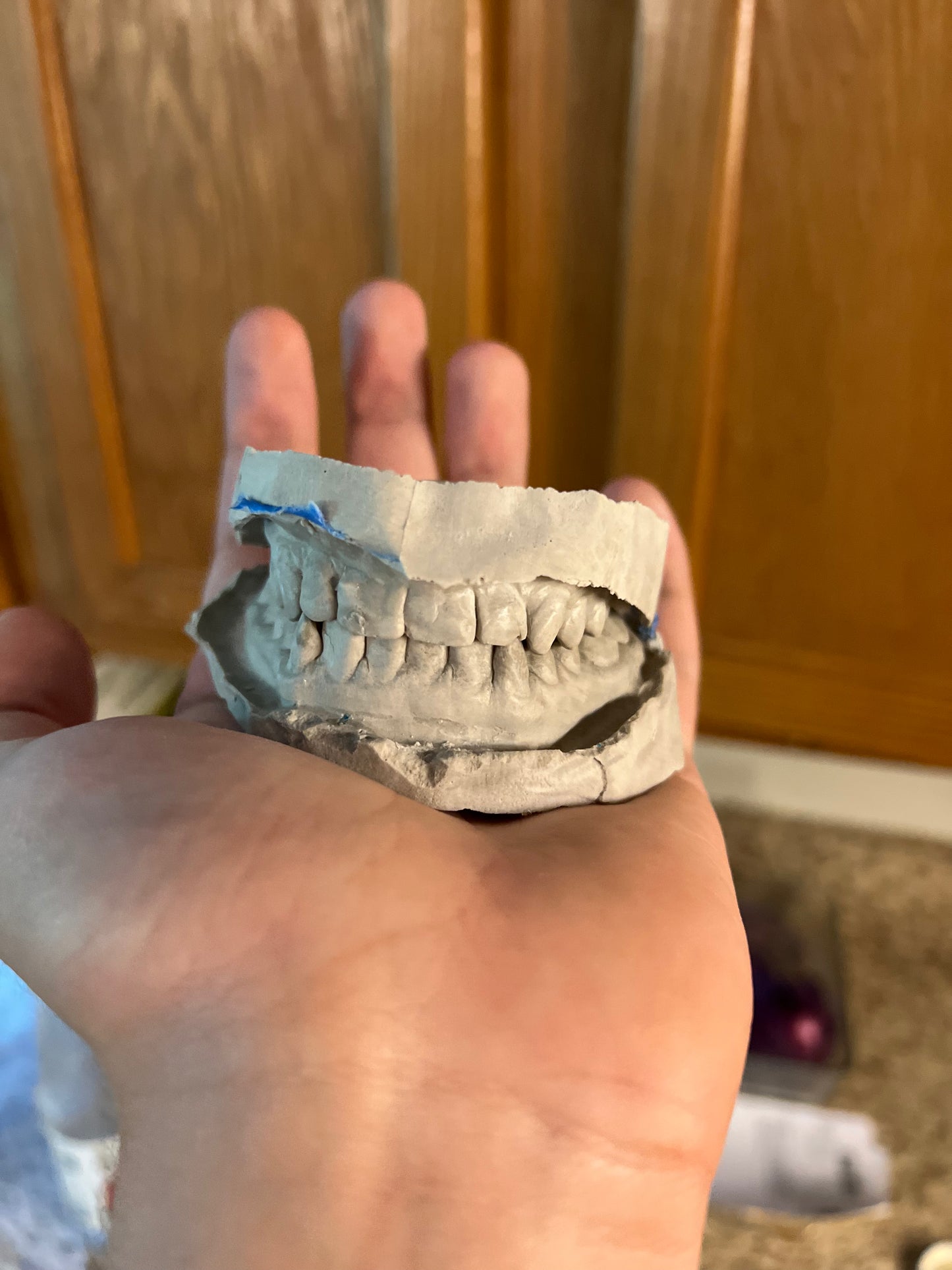 Custom Grillz By Maxwell The Jeweler